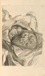 Anatomia humani corporis Pl.056
