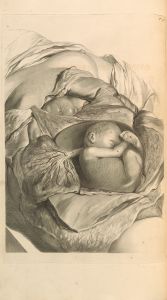 Anatomia humani corporis Pl.057
