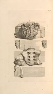 Anatomia humani corporis Pl.099